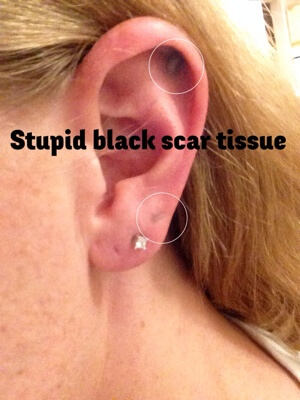 black-ear-scars.jpg