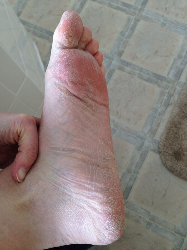 baby-foot-middle-phase.jpg