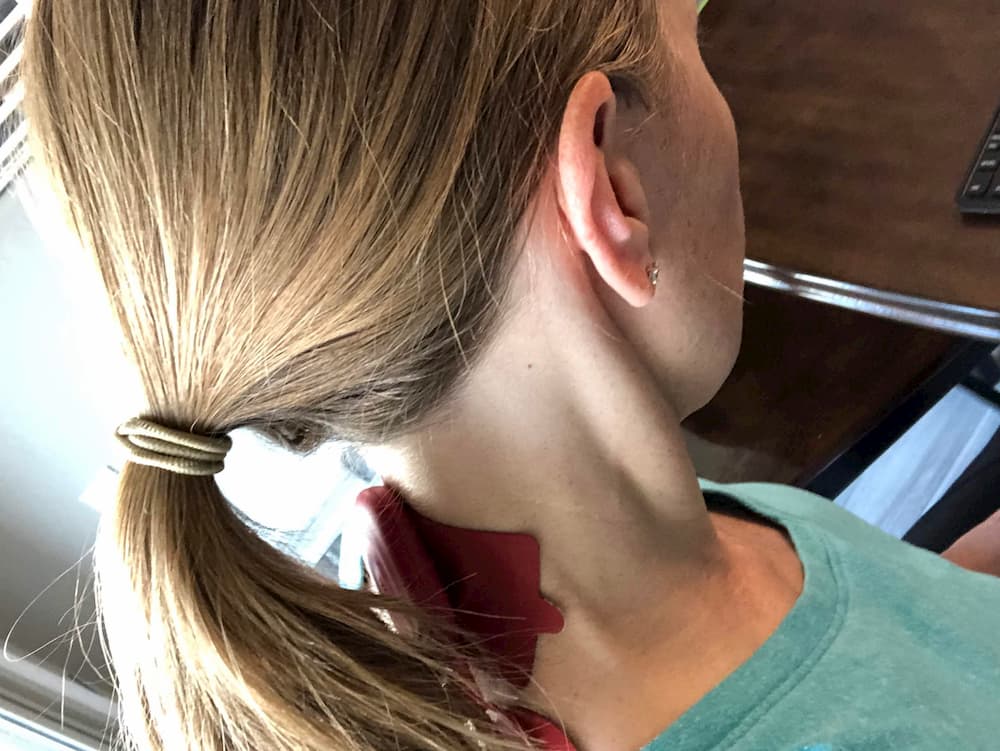 PowerDot pads on Jill's neck.