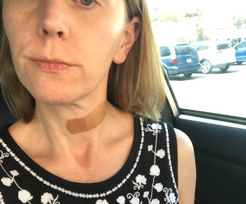 2017 in my car after a fine needle aspiration of a lump in my throat. I have a big band aid on my throat. 